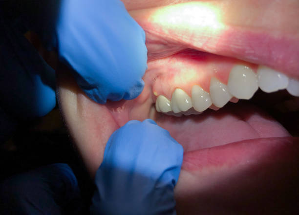 Best Root Canal Emergency Dentist  in North Richmond, CA