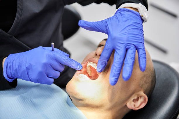 Best Chipped Tooth Repair Near Me  in North Richmond, CA